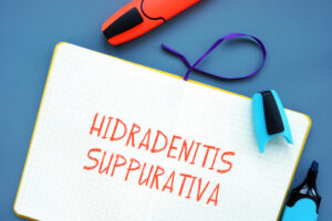 hidradenitis suppurativa