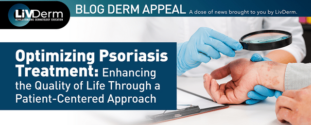 psoriasis treatment